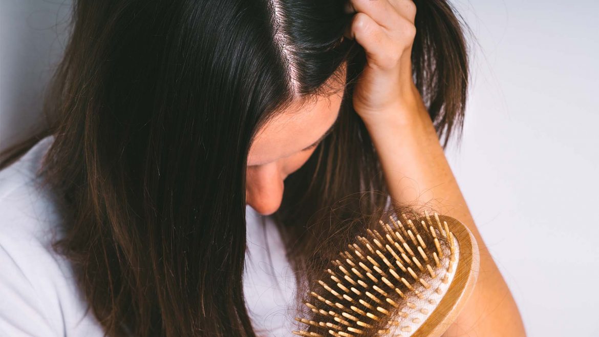 A woman suffering from hair loss