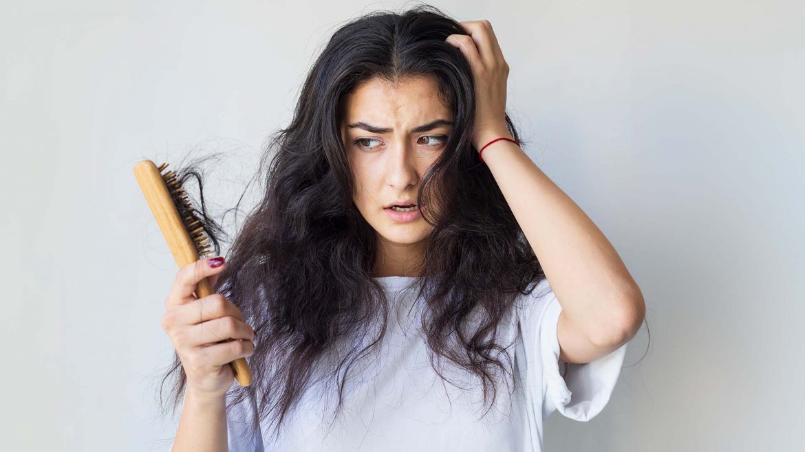 A woman with severe hairfall